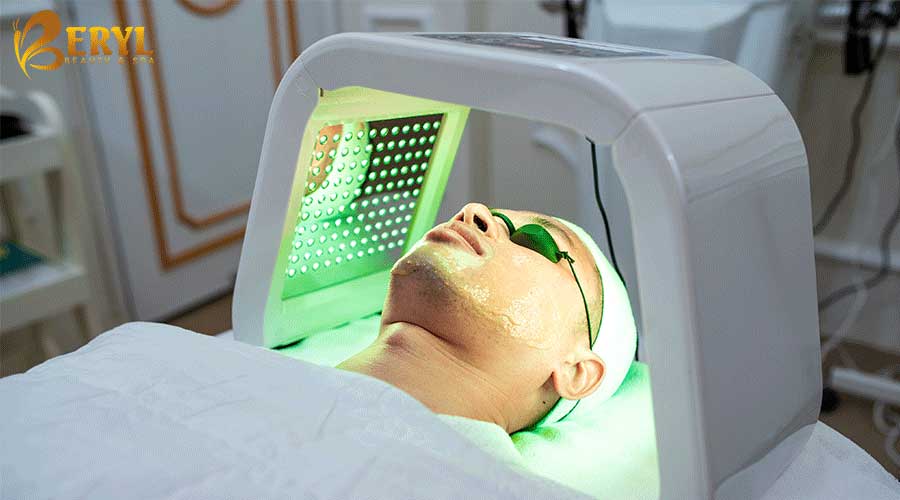 Điều trị mụn bằng ánh sáng sinh học Green Laser